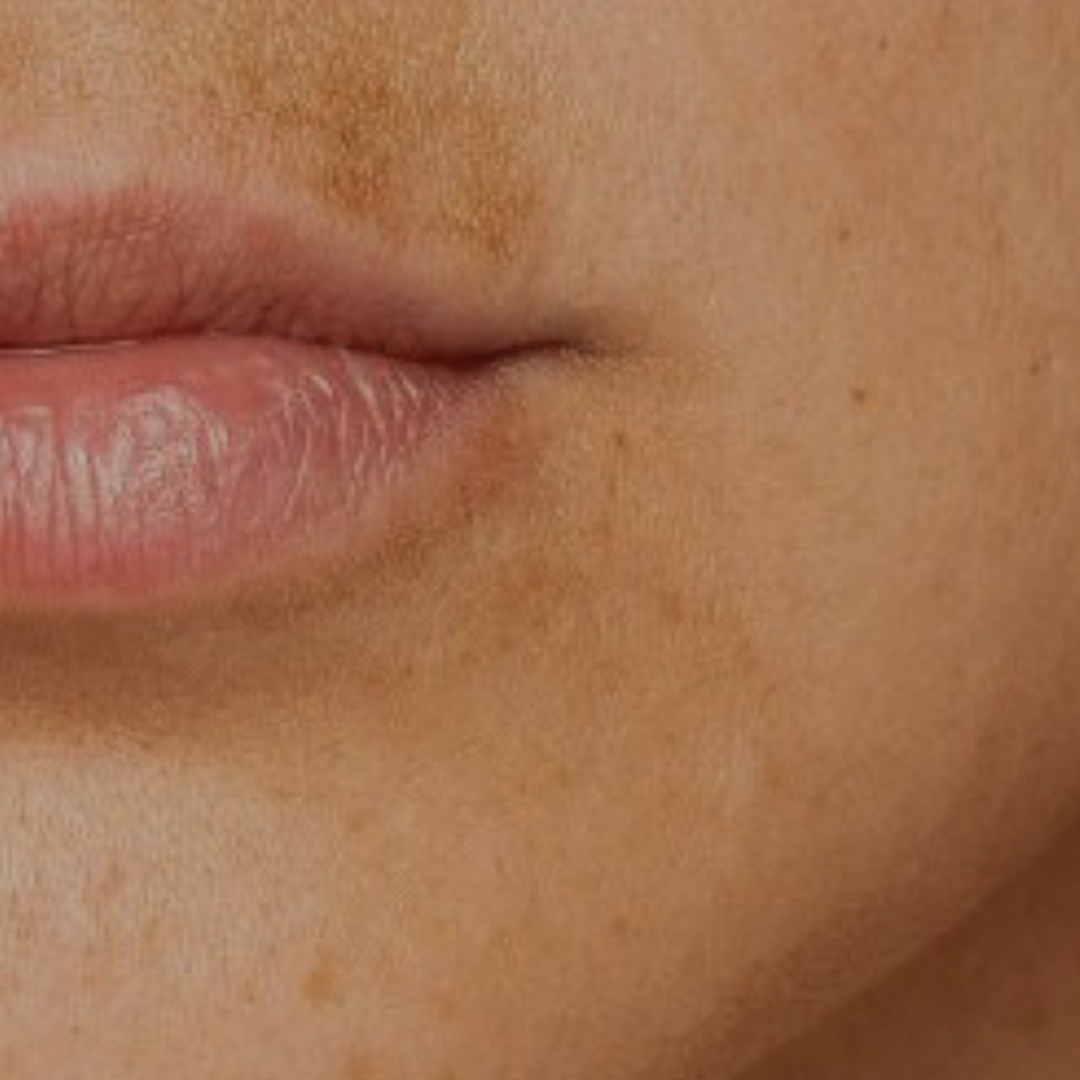 Mancha del bigote: todo lo que debes saber y, sí, cómo acabar con ella