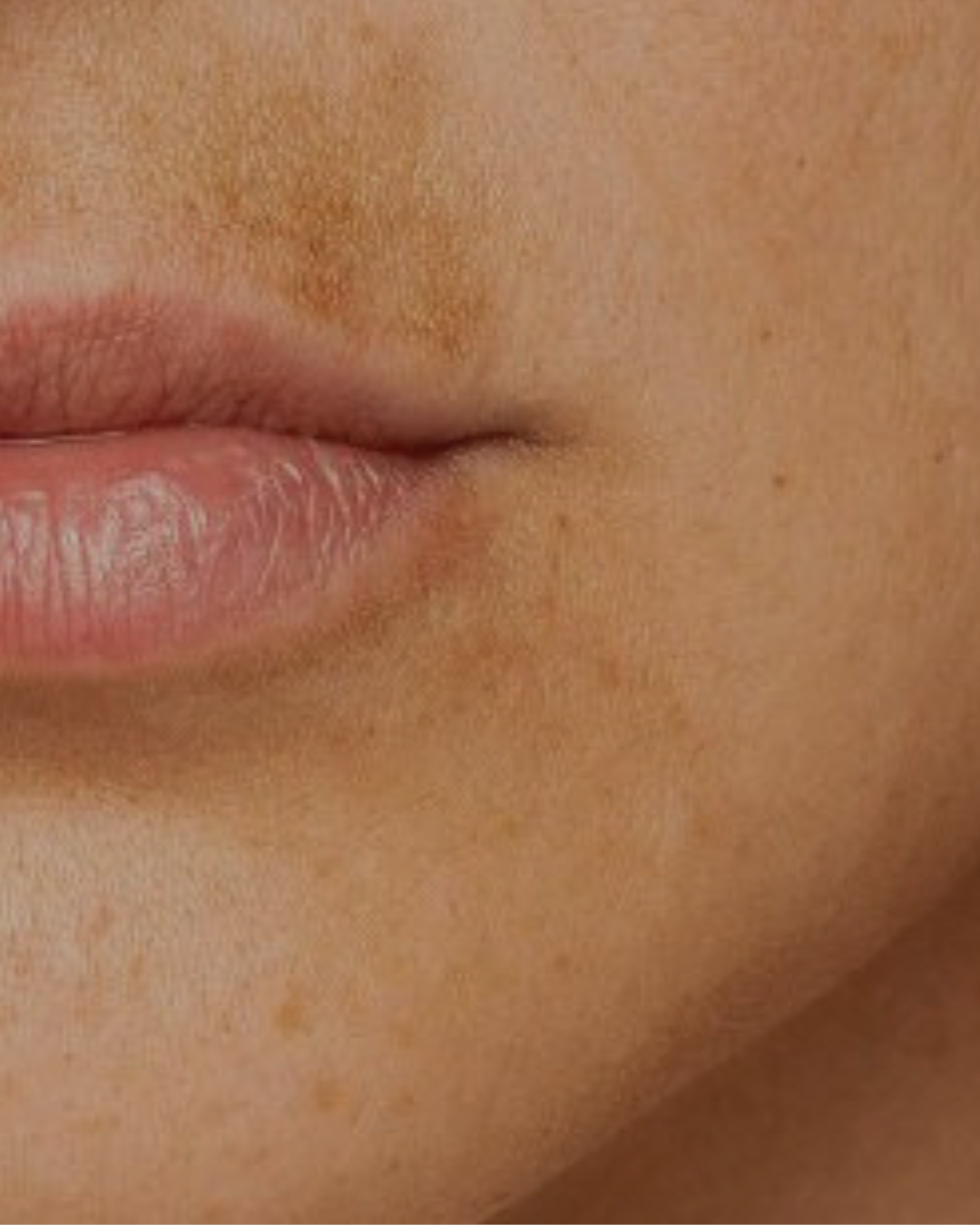 Mancha del bigote: todo lo que debes saber y, sí, cómo acabar con ella